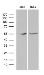 KLF5 Antibody in Western Blot (WB)