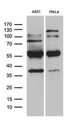 KLF5 Antibody in Western Blot (WB)