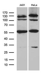 KLF5 Antibody in Western Blot (WB)