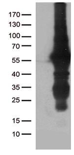 KLF5 Antibody in Western Blot (WB)