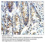KLF6 SV1 Polyclonal Antibody