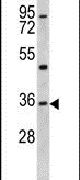 KLF6 Antibody in Western Blot (WB)