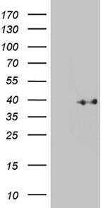KLF7 Antibody in Western Blot (WB)