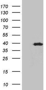 KLF7 Antibody in Western Blot (WB)