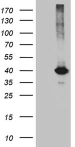 KLF7 Antibody in Western Blot (WB)