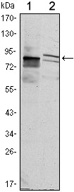 KLHL11 Antibody in Western Blot (WB)