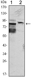KLHL11 Antibody in Western Blot (WB)