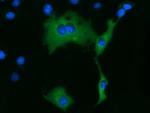 KLHL2 Antibody in Immunocytochemistry (ICC/IF)