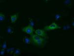 KLHL2 Antibody in Immunocytochemistry (ICC/IF)