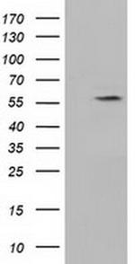 KLHL2 Antibody in Western Blot (WB)