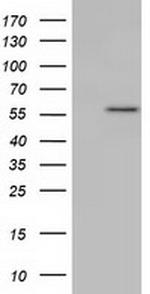 KLHL2 Antibody in Western Blot (WB)