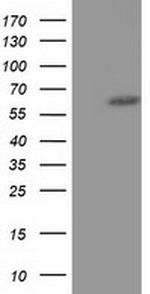 KLHL2 Antibody in Western Blot (WB)