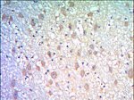 KLHL21 Monoclonal Antibody (2H4)