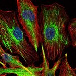KLHL22 Monoclonal Antibody (7B10)