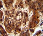 KLHL23 Antibody in Immunohistochemistry (IHC)