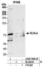 KLHL4 Polyclonal Antibody