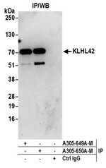 KLHL42 Antibody in Western Blot (WB)