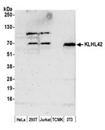 KLHL42 Polyclonal Antibody