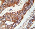 KLHL6 Antibody in Immunohistochemistry (IHC)