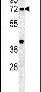 KLHL6 Antibody in Western Blot (WB)