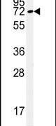 KLHL9 Antibody in Western Blot (WB)