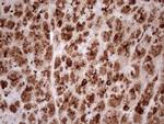 KLK3 Antibody in Immunohistochemistry (Paraffin) (IHC (P))