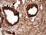 KLK3 Antibody in Immunohistochemistry (Paraffin) (IHC (P))
