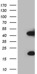 KLK3 Antibody in Western Blot (WB)