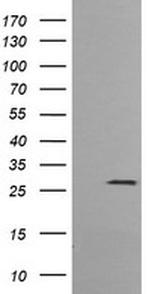 KLK8 Antibody in Western Blot (WB)