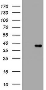 KLK8 Antibody in Western Blot (WB)