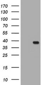KLK8 Antibody in Western Blot (WB)