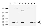 KLK8 Antibody in Western Blot (WB)