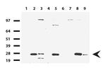 KLK8 Antibody in Western Blot (WB)
