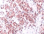 IGF2BP3 Antibody in Immunohistochemistry (IHC)