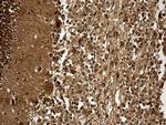 KPNB1 Antibody in Immunohistochemistry (Paraffin) (IHC (P))