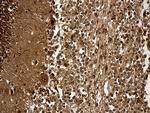 KPNB1 Antibody in Immunohistochemistry (Paraffin) (IHC (P))