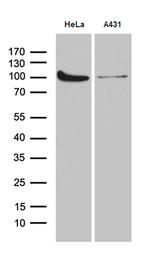 KPNB1 Antibody in Western Blot (WB)