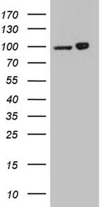 KPNB1 Antibody in Western Blot (WB)