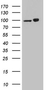 KPNB1 Antibody in Western Blot (WB)