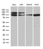 KPNB1 Antibody in Western Blot (WB)