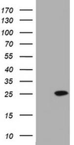 KRAS Antibody in Western Blot (WB)