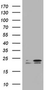 KRAS Antibody in Western Blot (WB)