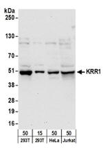 KRR1 Antibody in Western Blot (WB)