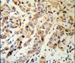Cytokeratin 13 Antibody in Immunohistochemistry (IHC)