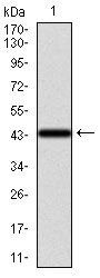 Cytokeratin 13 Monoclonal Antibody (3G4)