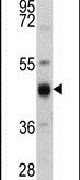 Cytokeratin 13 Antibody in Western Blot (WB)