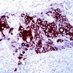 Cytokeratin 14 Antibody in Immunohistochemistry (IHC)