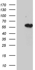 KRT14 Antibody in Western Blot (WB)