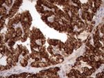 KRT16 Antibody in Immunohistochemistry (Paraffin) (IHC (P))