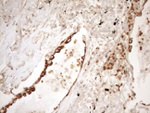 KRT16 Antibody in Immunohistochemistry (Paraffin) (IHC (P))